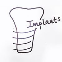 Basic-Implantology